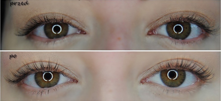 Keratynowy lifting rzęs i lash botox – efekty