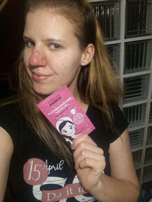 plasterki na wypryski