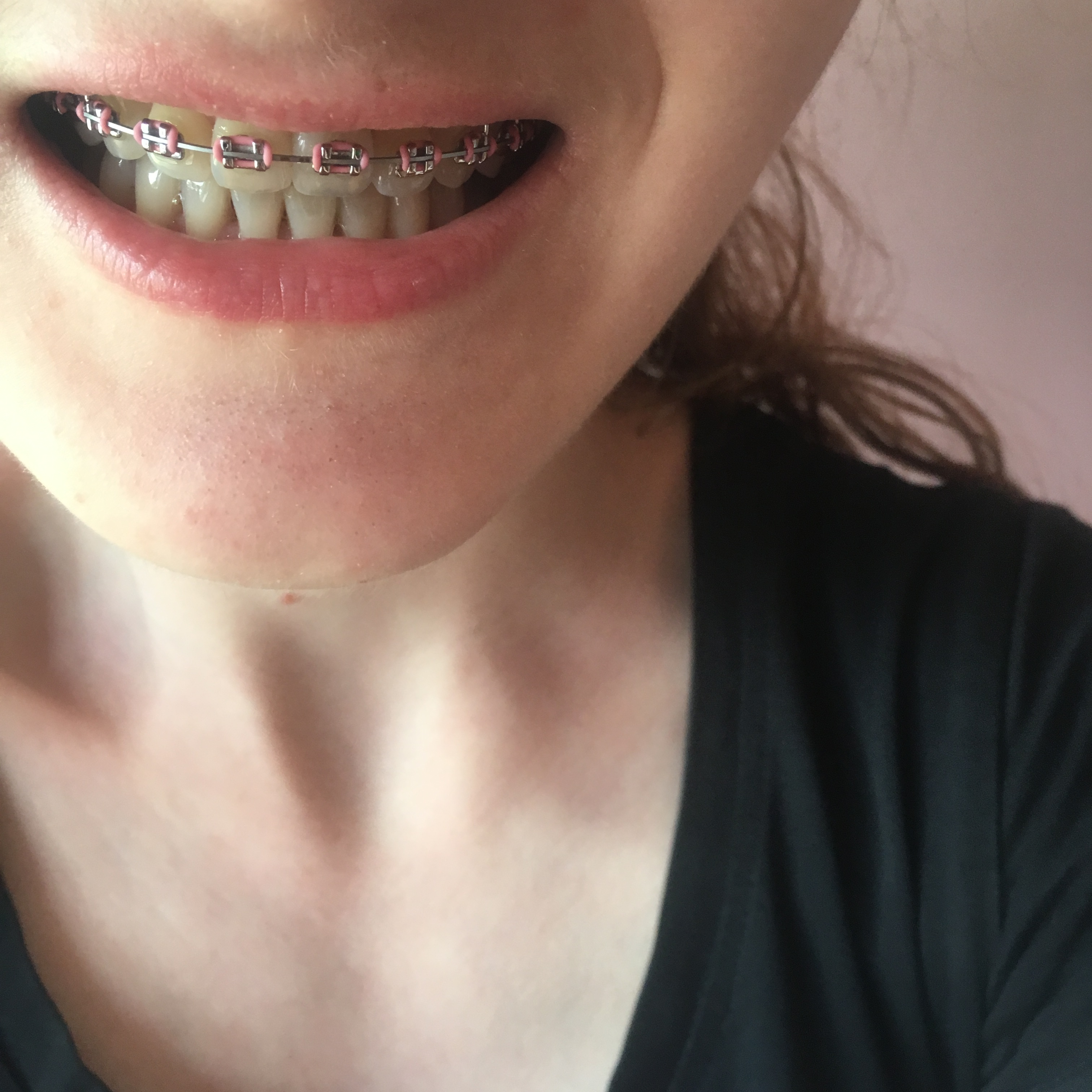 Aparatki - grupa wsparcia