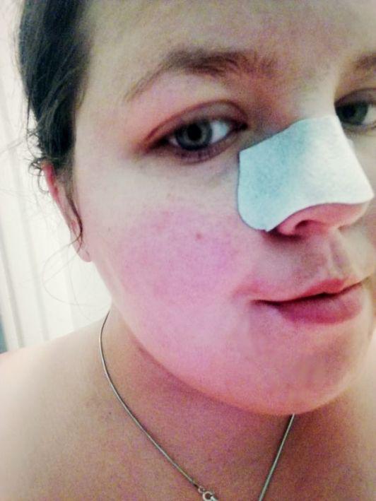 alvira plasterek na nos