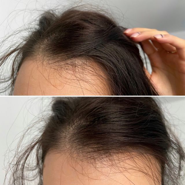 OnlyBio, Hair Balance, Wcierka pobudzająca wzrost włosów