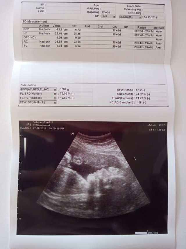 Jestem szczęśliwa bo..